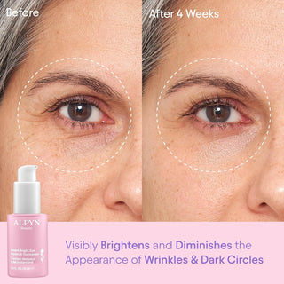 Alpyn Bright Eye